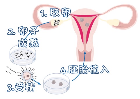 单基因病案例